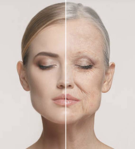 about